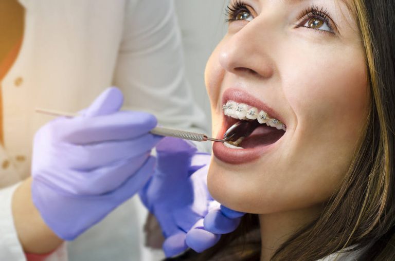 ¿La ortodoncia es moda?